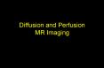Diffusion and Perfusion MR Imaging PowerPoint PPT Presentation