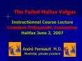 The Failed Hallux Valgus PowerPoint PPT Presentation
