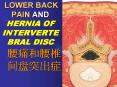LOWER BACK PAIN AND HERNIA OF INTERVERTEBRAL DISC PowerPoint PPT Presentation