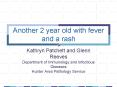 Another 2 year old with fever and a rash PowerPoint PPT Presentation