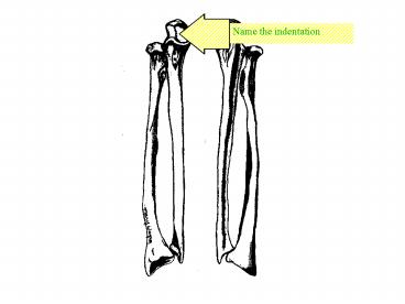 Name the indentation
