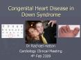 Congenital Heart Disease in Down Syndrome PowerPoint PPT Presentation
