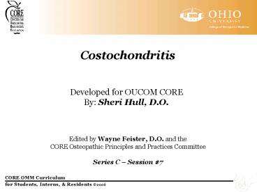 Costochondritis