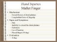Hand Injuries Mallet Finger PowerPoint PPT Presentation