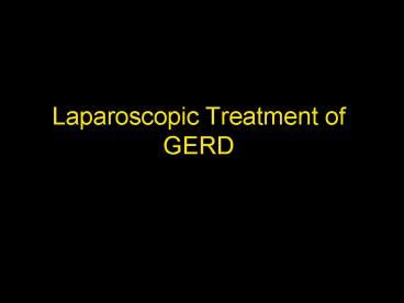Laparoscopic Treatment of GERD