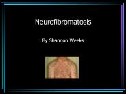 Neurofibromatosis