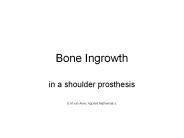 Bone Ingrowth