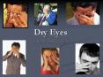 Dry Eyes PowerPoint PPT Presentation