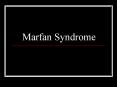 Marfan Syndrome PowerPoint PPT Presentation