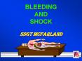 BLEEDING AND SHOCK SSgt McFarland PowerPoint PPT Presentation