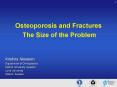 Osteoporosis and Fractures The Size of the Problem PowerPoint PPT Presentation