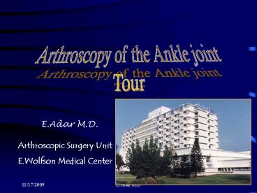 Arthroscopy of the Ankle joint