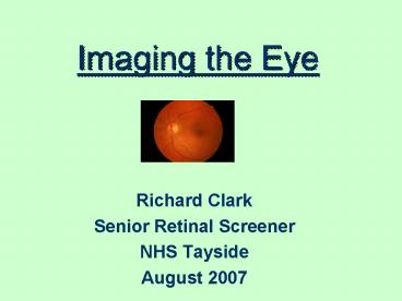 Imaging the Eye