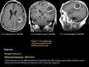 7.1a. Contrast axial T1 Wtd MRI