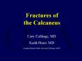 Fractures of the Calcaneus PowerPoint PPT Presentation