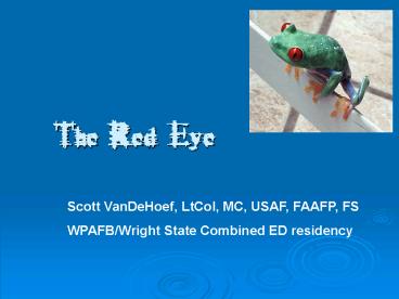 The Red Eye