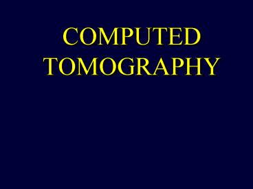 COMPUTED TOMOGRAPHY