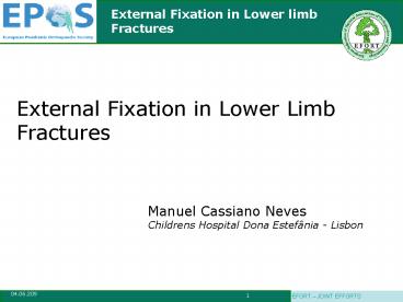 External Fixation in Lower limb Fractures