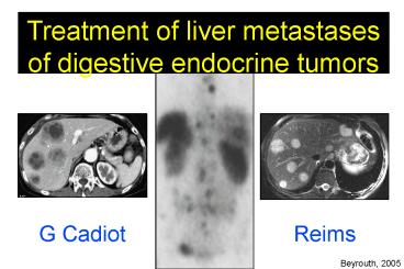 Aucun titre de diapositive