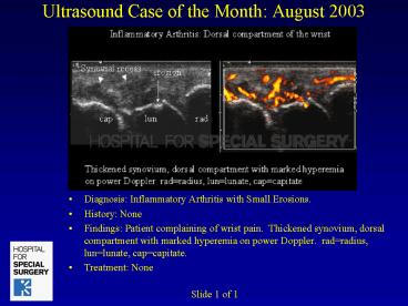 Ultrasound Case of the Month: August 2003