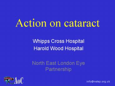 Action on cataract