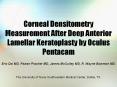 Corneal Densitometry Measurement After Deep Anterior Lamellar Keratoplasty by Oculus Pentacam PowerPoint PPT Presentation
