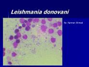 Leishmania donovani