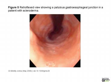 GI Motility online May 2006 doi:10.1038gimo29