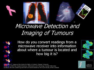 Microwave Detection and Imaging of Tumours