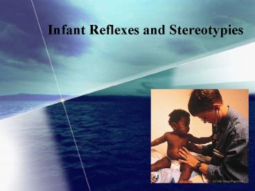 Infant Reflexes and Stereotypies