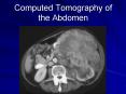 Computed Tomography of the Abdomen PowerPoint PPT Presentation