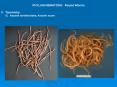 PHYLUM NEMATODA: Round Worms PowerPoint PPT Presentation