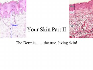 Your Skin Part II
