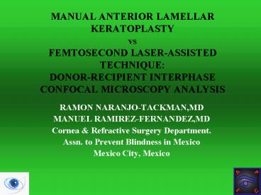 MANUAL ANTERIOR LAMELLAR KERATOPLASTY vs FEMTOSECOND LASERASSISTED TECHNIQUE: DONORRECIPIENT INTERPH