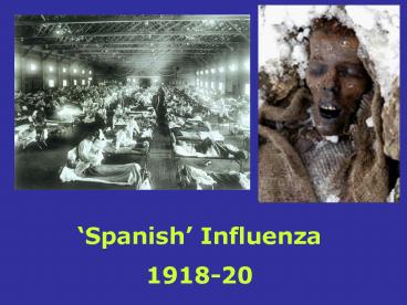 Spanish Influenza 191820