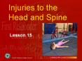Injuries to the Head and Spine PowerPoint PPT Presentation