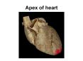 Apex of heart PowerPoint PPT Presentation
