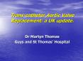 Trans-catheter Aortic Valve Replacement: a UK update. PowerPoint PPT Presentation