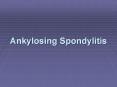 Ankylosing Spondylitis PowerPoint PPT Presentation