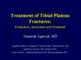 Treatment of Tibial Plateau Fractures: PowerPoint PPT Presentation