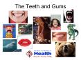 The Teeth and Gums PowerPoint PPT Presentation