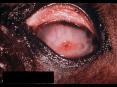 MYCOTIC KERATITIS PowerPoint PPT Presentation
