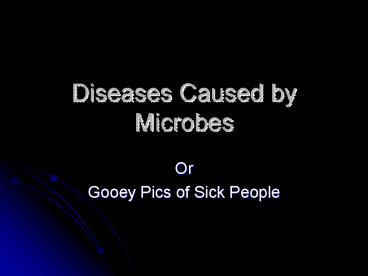 Diseases Caused by Microbes