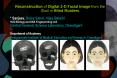 Reconstruction of Digital 2D Facial Image from the Skull in Blind Murders PowerPoint PPT Presentation