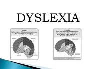 Dyslexia