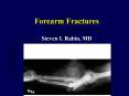 Forearm Fractures PowerPoint PPT Presentation