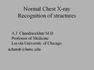 Normal Chest X-ray Recognition of structures