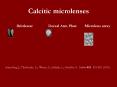 Calcitic microlenses PowerPoint PPT Presentation