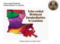 Colorcoded Wristband Standardization in Louisiana PowerPoint PPT Presentation