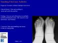 Teaching File Case: Arthritis PowerPoint PPT Presentation